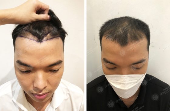 Trương Thiên Thanh