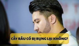 Chuyên gia giải đáp: Cấy râu có bị rụng lại không?