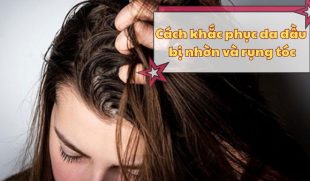 Cách khắc phục tình trạng da đầu bị nhờn rụng tóc hiệu quả