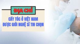 Địa chỉ cấy tóc ở Việt Nam uy tín, được nghệ sĩ tin chọn