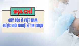 Địa chỉ cấy tóc ở Việt Nam uy tín, được nghệ sĩ tin chọn