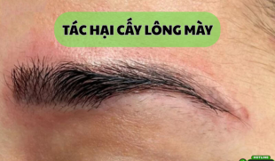 Tác hại cấy lông mày: Cảnh báo từ chuyên gia để tránh “tiền mất tật mang”