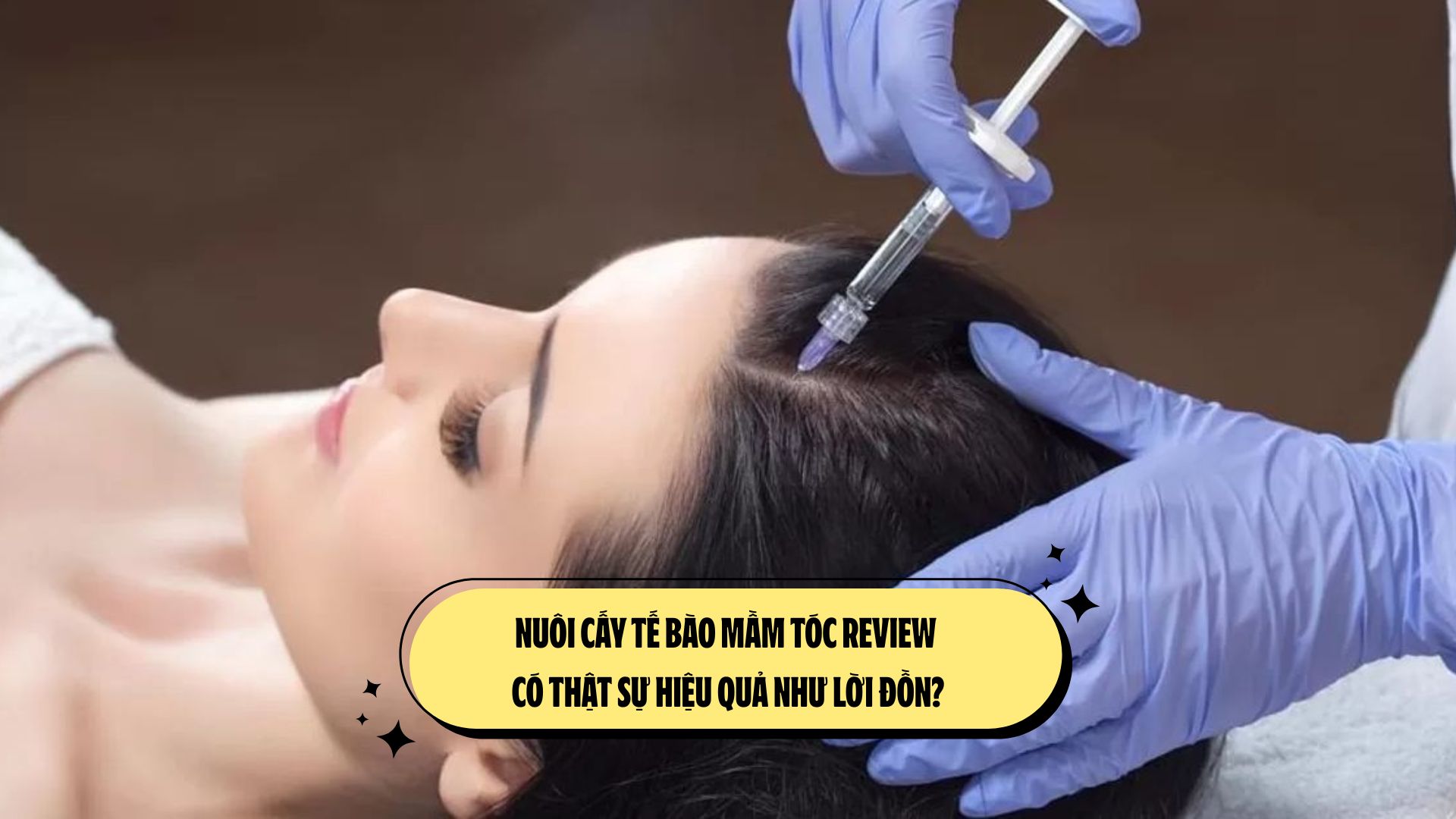 CẤY TẾ BÀO GỐC HỖ TRỢ CẢI THIỆN LÀN DA HƯ TỔN