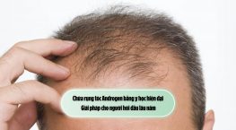 Chữa rụng tóc Androgen bằng y học hiện đại: Giải pháp cho người hói đầu lâu năm