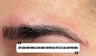 Cấy lông mày hỏng là do đâu? Chuyên gia tiết lộ 5 sai lầm phổ biến