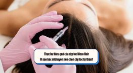 Thực hư hiệu quả của cấy tóc Meso Hair – Vì sao bác sĩ khuyên nên chọn cấy tóc tự thân?