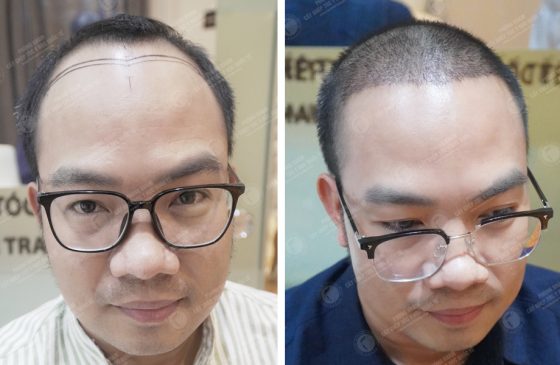 Nguyễn Anh Đức