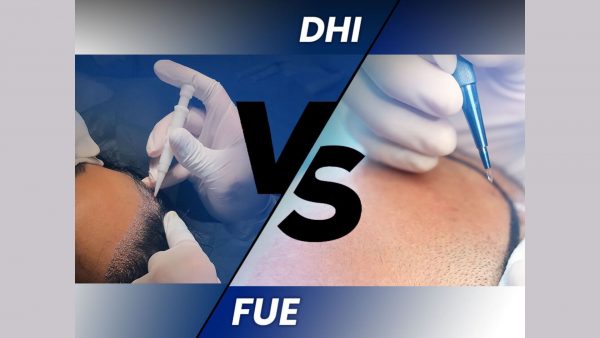 Cấy tóc FUE, HAT và DHI: Phương pháp nào an toàn và hiệu quả nhất?