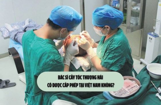 Bác sĩ cấy tóc Thượng Hải có được cấp phép tại Việt Nam không?