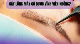 Cấy lông mày có được vĩnh viễn không? Bác sĩ giải đáp chi tiết
