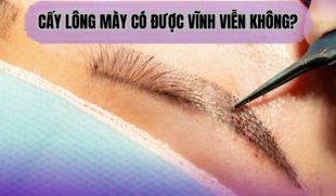 Cấy lông mày có được vĩnh viễn không? Bác sĩ giải đáp chi tiết