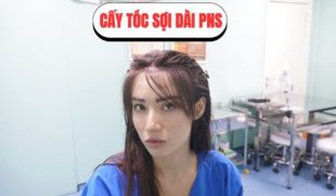 Phương pháp cấy tóc dài PNS – Giải pháp phục hồi tóc tự nhiên, không cần cắt tóc