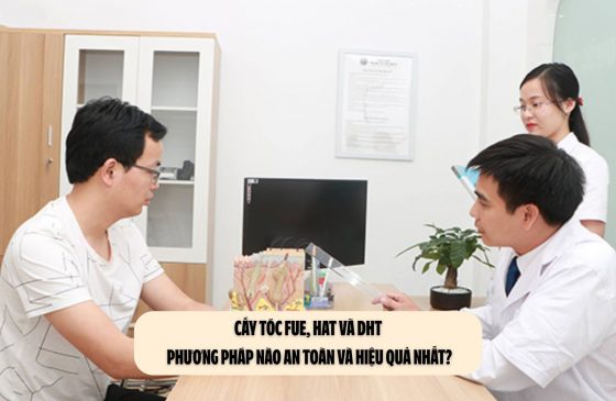 Cấy tóc FUE, HAT và DHT - Phương pháp nào an toàn và hiệu quả nhất