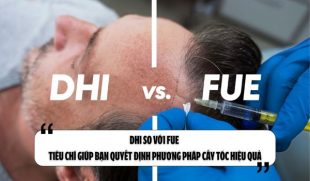DHI so với FUE – Tiêu chí giúp bạn quyết định phương pháp cấy tóc hiệu quả