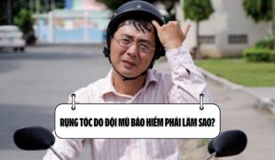 Rụng tóc do đội mũ bảo hiểm phải làm sao?