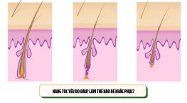 Nang tóc yếu do đâu? Làm thế nào để khắc phục?