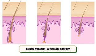 Nang tóc yếu do đâu? Làm thế nào để khắc phục?