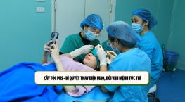 Cấy tóc PNS – Bí quyết thay diện mạo, đổi vận mệnh tức thì