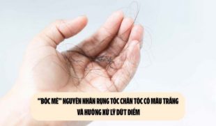 “Bóc mẽ” nguyên nhân rụng tóc chân tóc có màu trắng và hướng xử lý dứt điểm