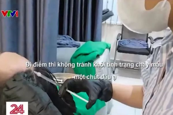 VTV vén màn phòng khám tóc chui không phép: Lời cảnh tỉnh cho những ai đang muốn cấy tóc VTV vén màn phòng khám tóc chui không phép: Lời cảnh tỉnh cho những ai đang muốn cấy tóc