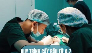 Quy trình cấy râu từ A – Z: Nam giới cần biết trước khi thực hiện