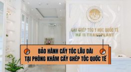 Bảo hành cấy tóc lâu dài: Chính sách và quyền lợi tại Phòng khám Cấy ghép tóc Y học Quốc tế