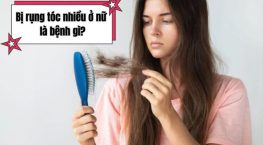 Bị rụng tóc nhiều ở nữ là bệnh gì? Nhận biết sớm để bảo vệ sức khỏe và mái tóc