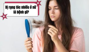 Bị rụng tóc nhiều ở nữ là bệnh gì? Nhận biết sớm để bảo vệ sức khỏe và mái tóc