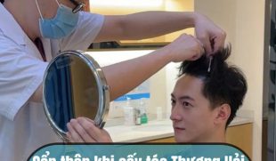 Cẩn thận khi cấy tóc Thượng Hải đang tràn lan tại Việt Nam