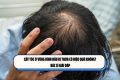 Cấy tóc ở vùng đỉnh đầu bị thưa có hiệu quả không? Bác sĩ giải đáp