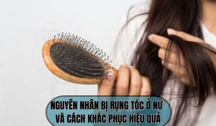 Nguyên nhân bị rụng tóc ở nữ và cách khắc phục hiệu quả