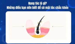 Nang tóc là gì? Tất tần tật bạn cần biết để chăm sóc mái tóc khỏe đẹp