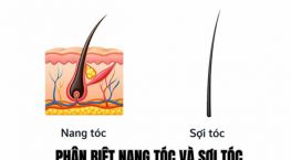 Phân biệt nang tóc và sợi tóc: Hiểu đúng để chăm sóc tóc hiệu quả