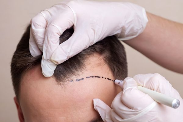 Top bác sĩ chuyên khoa tạo hình tóc giỏi, được nhiều khách hàng tin chọn 