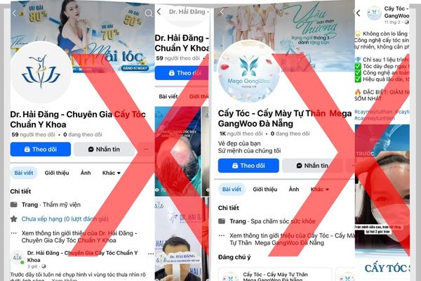 Cảnh báo: Các đơn vị sử dụng hình ảnh trái phép trong quảng cáo cấy ghép tóc