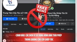 Cảnh báo: Các đơn vị sử dụng hình ảnh trái phép trong quảng cáo cấy ghép tóc