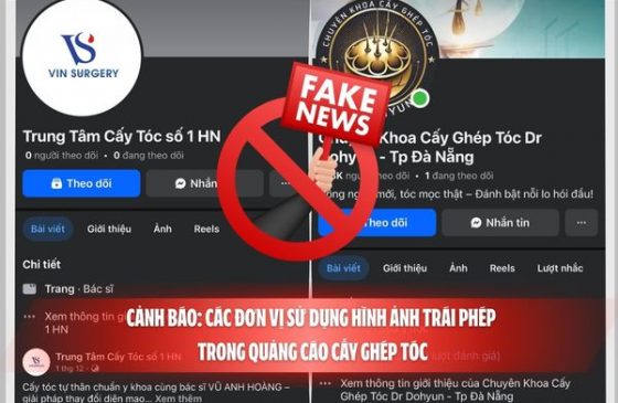 Cảnh báo: Các đơn vị sử dụng hình ảnh trái phép trong quảng cáo cấy ghép tóc