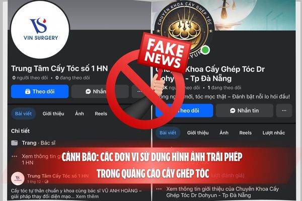 Cảnh báo: Các đơn vị sử dụng hình ảnh trái phép trong quảng cáo cấy ghép tóc