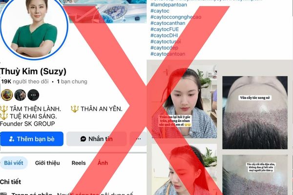 Cảnh báo: Các đơn vị sử dụng hình ảnh trái phép trong quảng cáo cấy ghép tóc