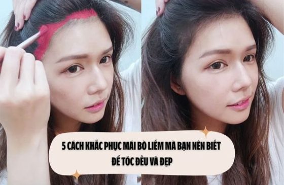 5 Cách khắc phục mái bò liếm mà bạn nên biết để tóc đều và đẹp