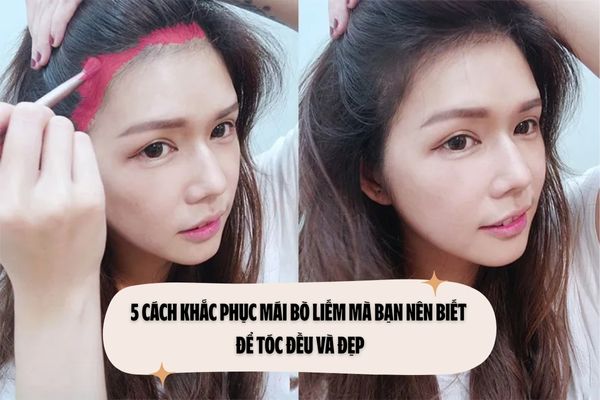 5 Cách khắc phục mái bò liếm mà bạn nên biết để tóc đều và đẹp