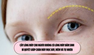 Cấy lông mày cho người không có lông mày bẩm sinh: Bí quyết giúp chân mày mọc dày, mềm và tự nhiên