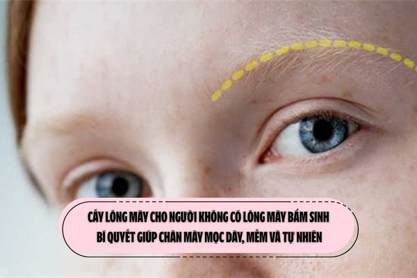 Cấy lông mày cho người không có lông mày bẩm sinh: Bí quyết giúp chân mày mọc dày, mềm và tự nhiên