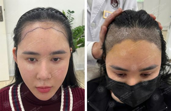 Nguyễn Tuyết Lan