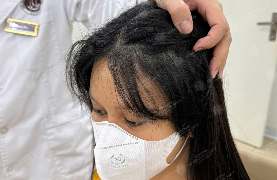 Trần Thị Huyền - Cấy tóc đường chữ M 8