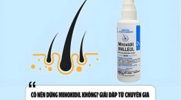Có nên dùng Minoxidil không? Giải đáp từ chuyên gia 