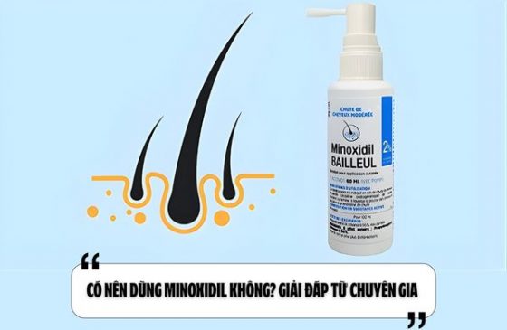 Có nên dùng Minoxidil không? Giải đáp từ chuyên gia 