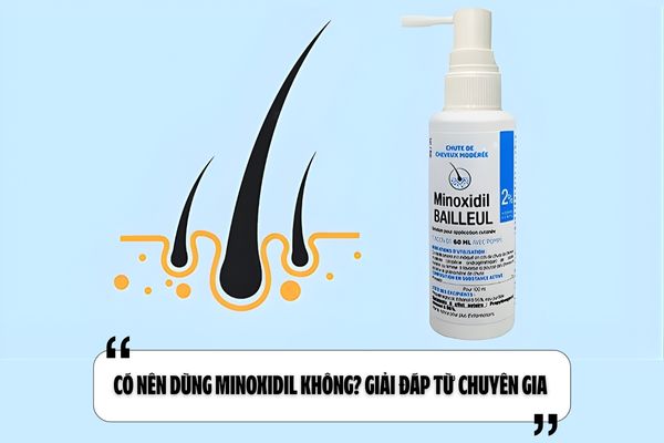 Có nên dùng Minoxidil không? Giải đáp từ chuyên gia 