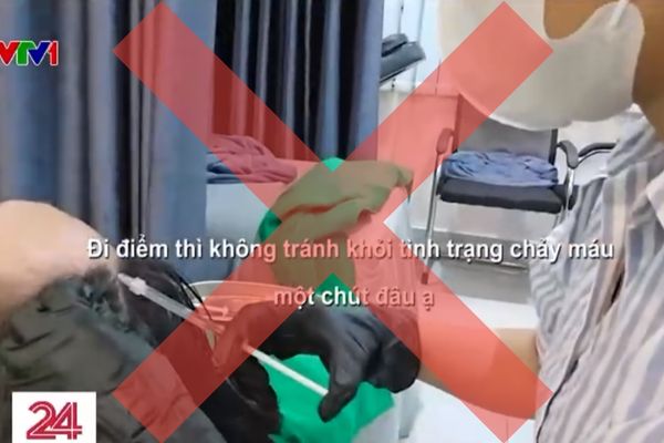 Một liệu trình PRP giá bao nhiêu – Cập nhật chi phí mới nhất