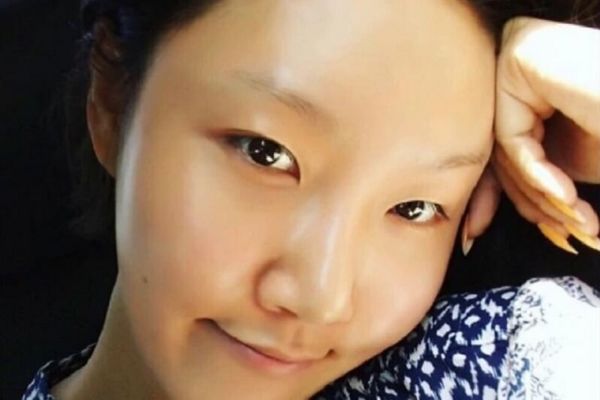 Cấy lông mày cho người không có lông mày bẩm sinh: Bí quyết giúp chân mày mọc dày, mềm và tự nhiên